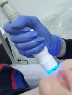 Радиоволновый лифтинг фото