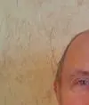 Rastyapinfedor
