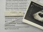 Тест-кассета для определения беременности Know Now Optima фото