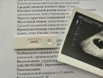 Тест-кассета для определения беременности Know Now Optima фото