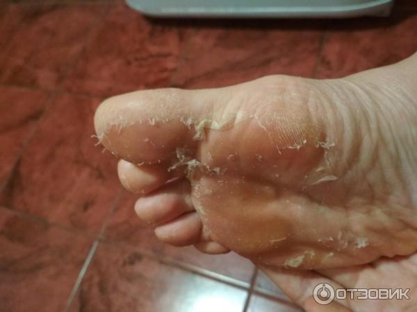 Носки педикюрные пилинговые MiFo Super Exfoliating Foot Socks For Pedicure фото