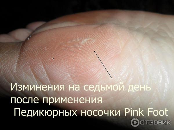 Педикюрные носочки Pink Foot фото