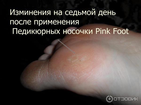 Педикюрные носочки Pink Foot фото