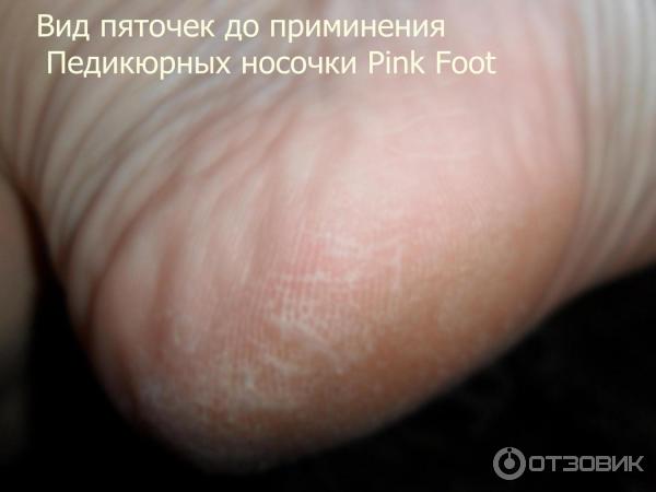 Педикюрные носочки Pink Foot фото