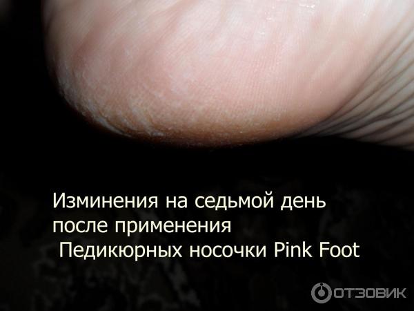 Педикюрные носочки Pink Foot фото