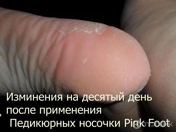 Педикюрные носочки Pink Foot фото