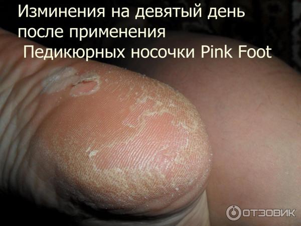 Педикюрные носочки Pink Foot фото