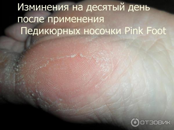 Педикюрные носочки Pink Foot фото