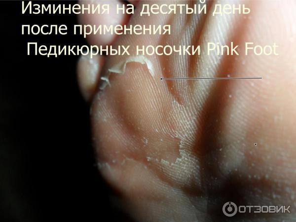 Педикюрные носочки Pink Foot фото