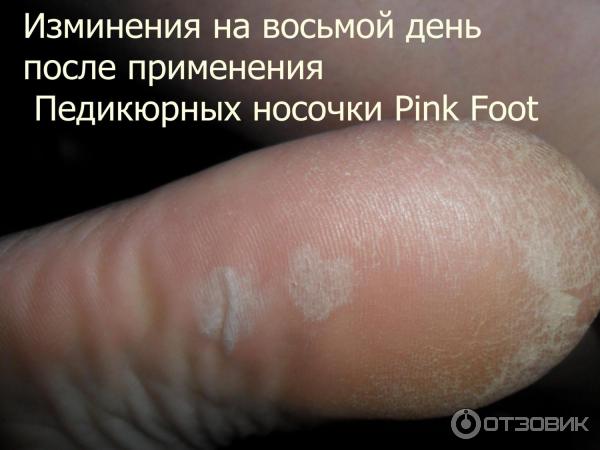 Педикюрные носочки Pink Foot фото