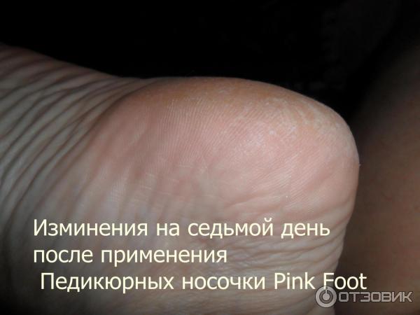 Педикюрные носочки Pink Foot фото