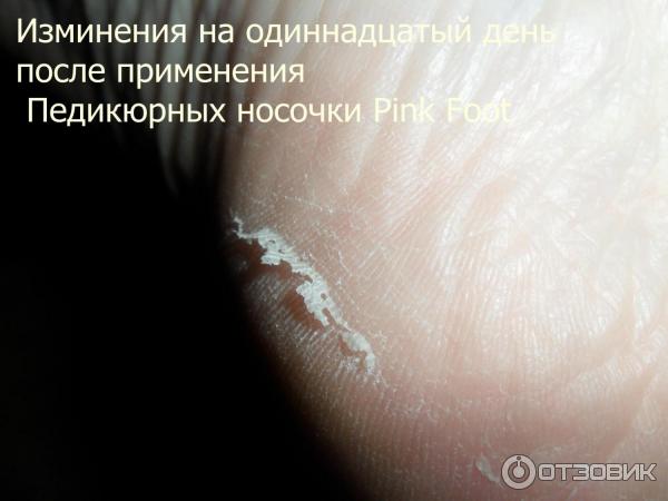 Педикюрные носочки Pink Foot фото