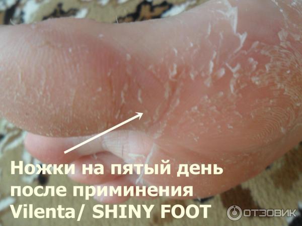 Отшелушивающая маска-носочки для ног Vilenta Shiny Foot фото