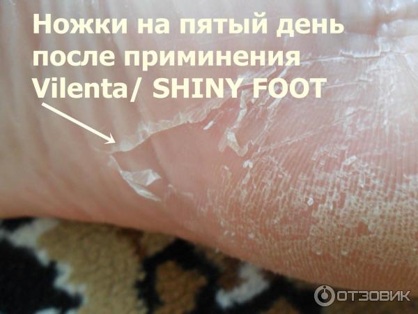 Отшелушивающая маска-носочки для ног Vilenta Shiny Foot фото