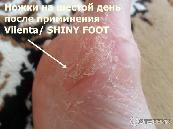 Отшелушивающая маска-носочки для ног Vilenta Shiny Foot фото