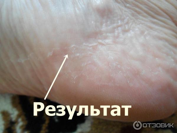 Отшелушивающая маска-носочки для ног Vilenta Shiny Foot фото