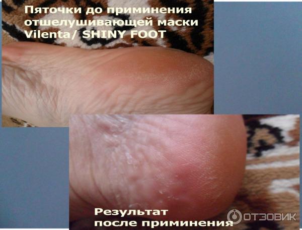 Отшелушивающая маска-носочки для ног Vilenta Shiny Foot фото