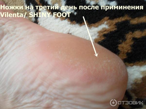 Отшелушивающая маска-носочки для ног Vilenta Shiny Foot фото