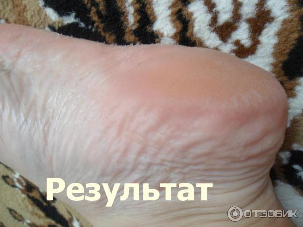 Отшелушивающая маска-носочки для ног Vilenta Shiny Foot фото