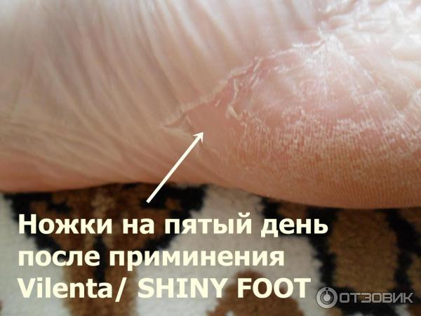 Отшелушивающая маска-носочки для ног Vilenta Shiny Foot фото