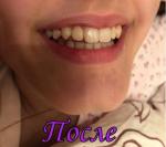 Стоматологическая клиника "Метелица" (Россия, Санкт-Петербург) фото