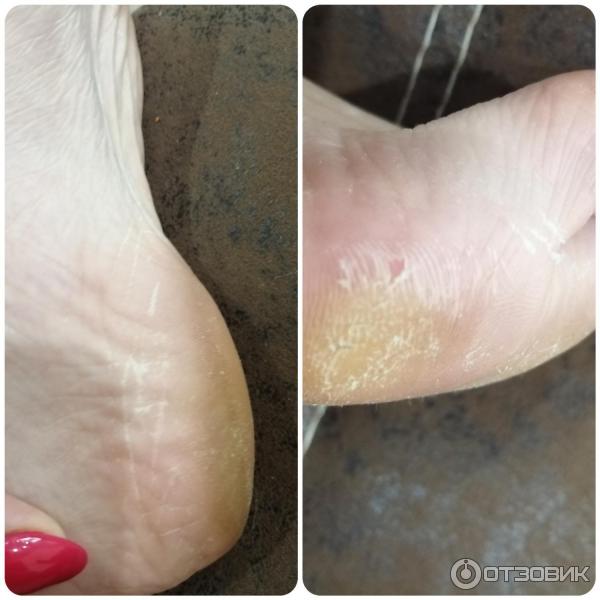 Отшелушивающая маска-носочки для ног Vilenta Shiny Foot фото