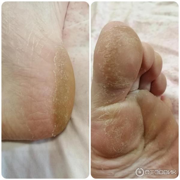 Отшелушивающая маска-носочки для ног Vilenta Shiny Foot фото