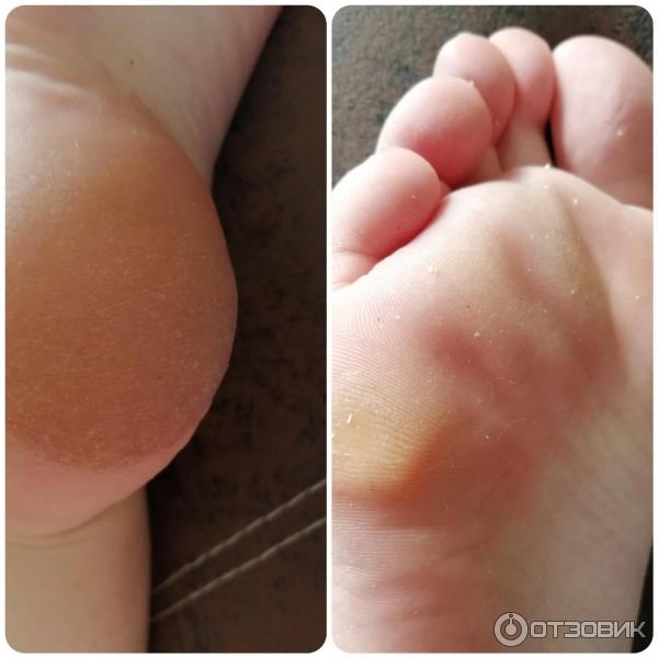 Отшелушивающая маска-носочки для ног Vilenta Shiny Foot фото