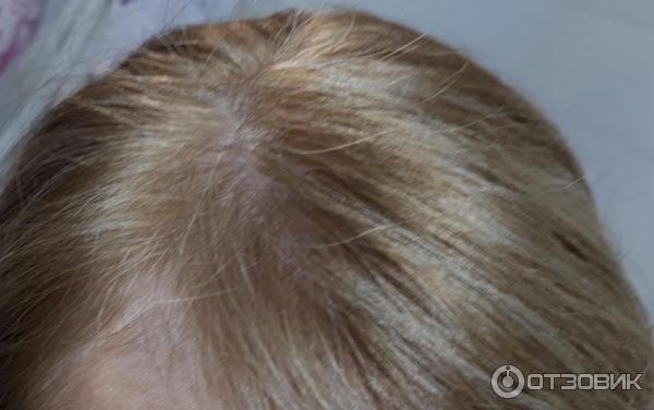 Краска для волос Schwarzkopf Color Expert OmegaPlex фото