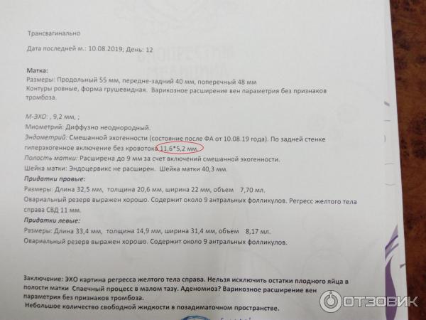 Анэмбриония - причины, симптомы, признаки, последствия, диагностика, лечение