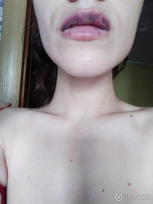 "Kylie Jenner Challenge" Kylie Jenner Challenge Makes White Girls Look Black - Y