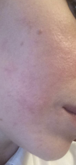 Мазь для наружного применения от псориаза Qicun baxian фото