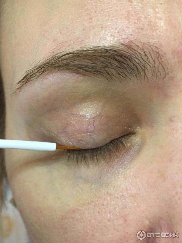 Сыворотка для роста бровей и ресниц TopLash Lash and Brow Booster фото